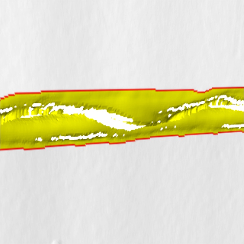 焊縫缺陷檢測系統——焊接質量的智能衛士